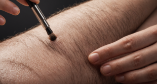 Removing Ingrown Hairs Effectively